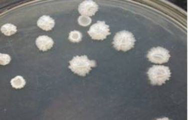 芽孢杆菌检测